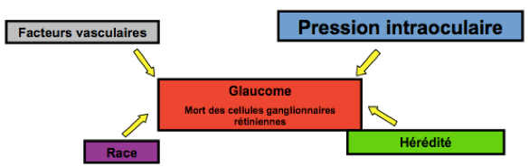 Schéma Moyens de traitement du glaucome